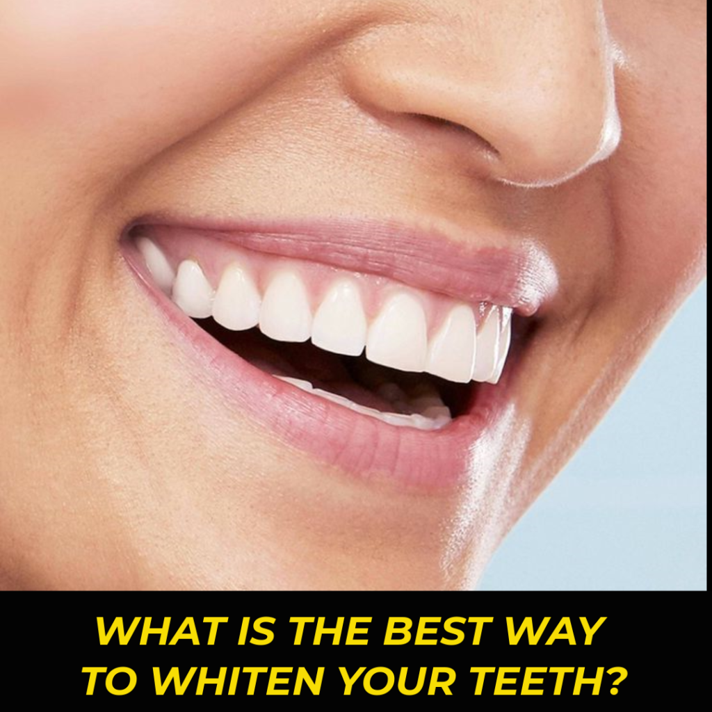 What is the best way to whiten your teeth?